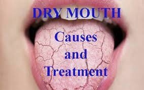 Causes and treatment of dry mouth
